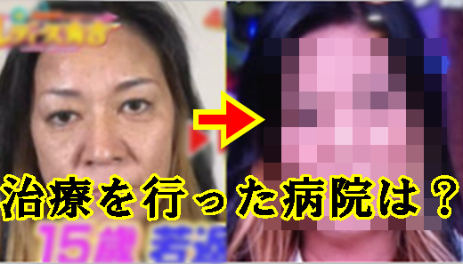 ジャガー横田が幹細胞治療(手術)した病院はどこ？整形前と後を画像で比較！